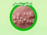 سلامت hpv