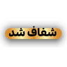 رفع ماتی چراغ خودرو